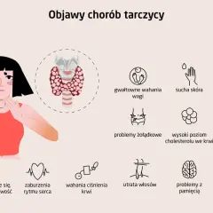 Ilustracja przedstawia objawy chorób tarczycy, w tym hashimoto: zmęczenie, problemy z wagą, skórą, włosami, pamięcią i bóle mięśni.