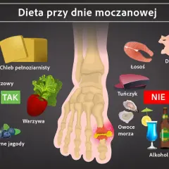 Dieta przy dnie moczanowej: TAK - nabiał, chleb, warzywa, owoce. NIE - drób, ryby, czerwone mięso, podroby, owoce morza, alkohol. Czego nie jeść przy dnie moczanowej.