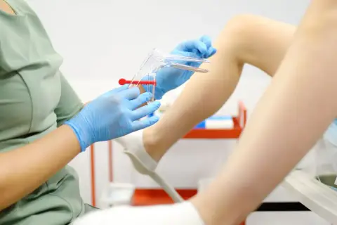 Lekarz w niebieskich rękawiczkach przygotowuje wziernik do badania, które może pomóc zdiagnozować infekcja pochwy objawy.
