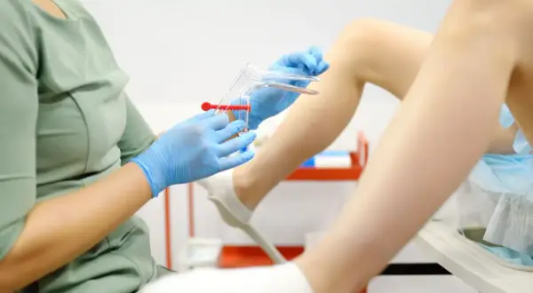 Lekarz w niebieskich rękawiczkach przygotowuje wziernik do badania, które może pomóc zdiagnozować infekcja pochwy objawy.
