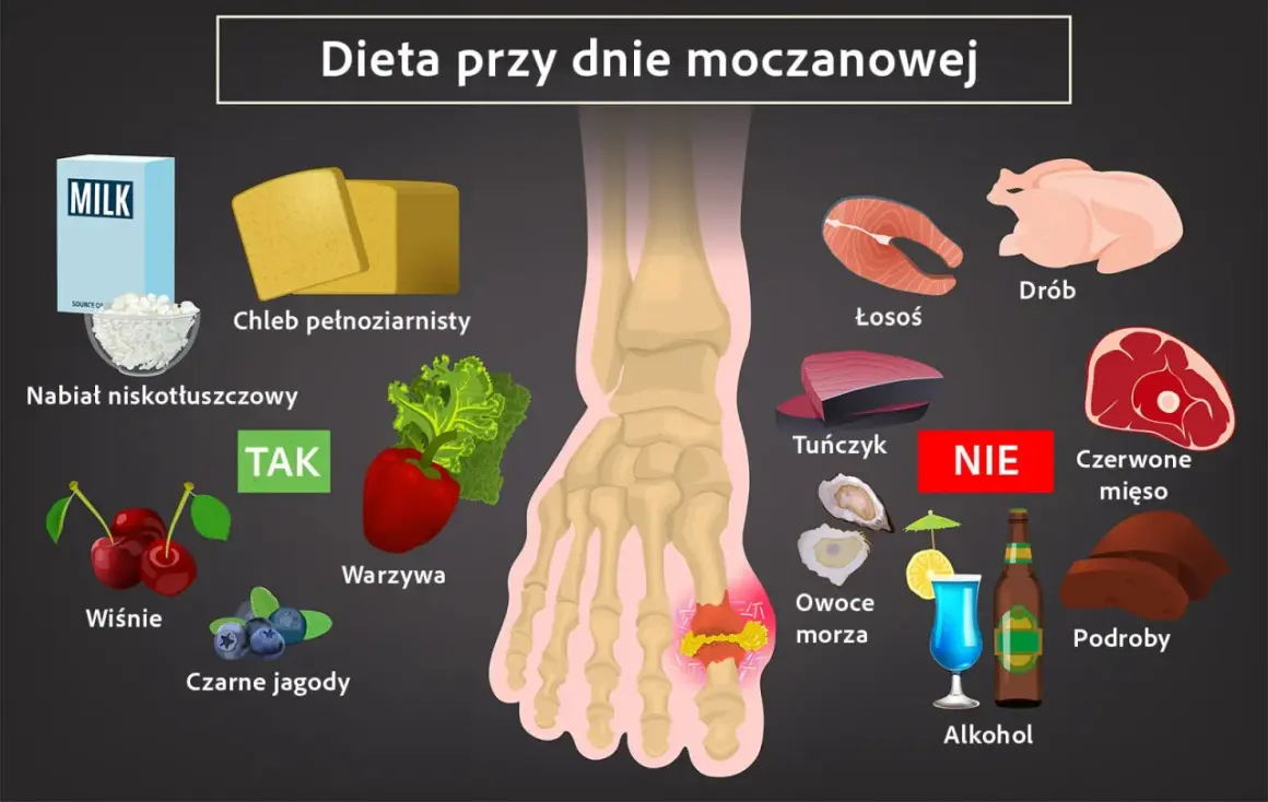 Dieta przy dnie moczanowej: TAK - nabiał, chleb, warzywa, owoce. NIE - drób, ryby, czerwone mięso, podroby, owoce morza, alkohol. Czego nie jeść przy dnie moczanowej.