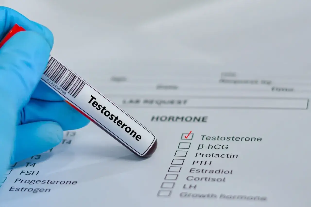 Badanie poziomu testosteronu, kluczowe dla oceny objaw&oacute;w menopauzy u mężczyzn. Wyniki analizy hormon&oacute;w.