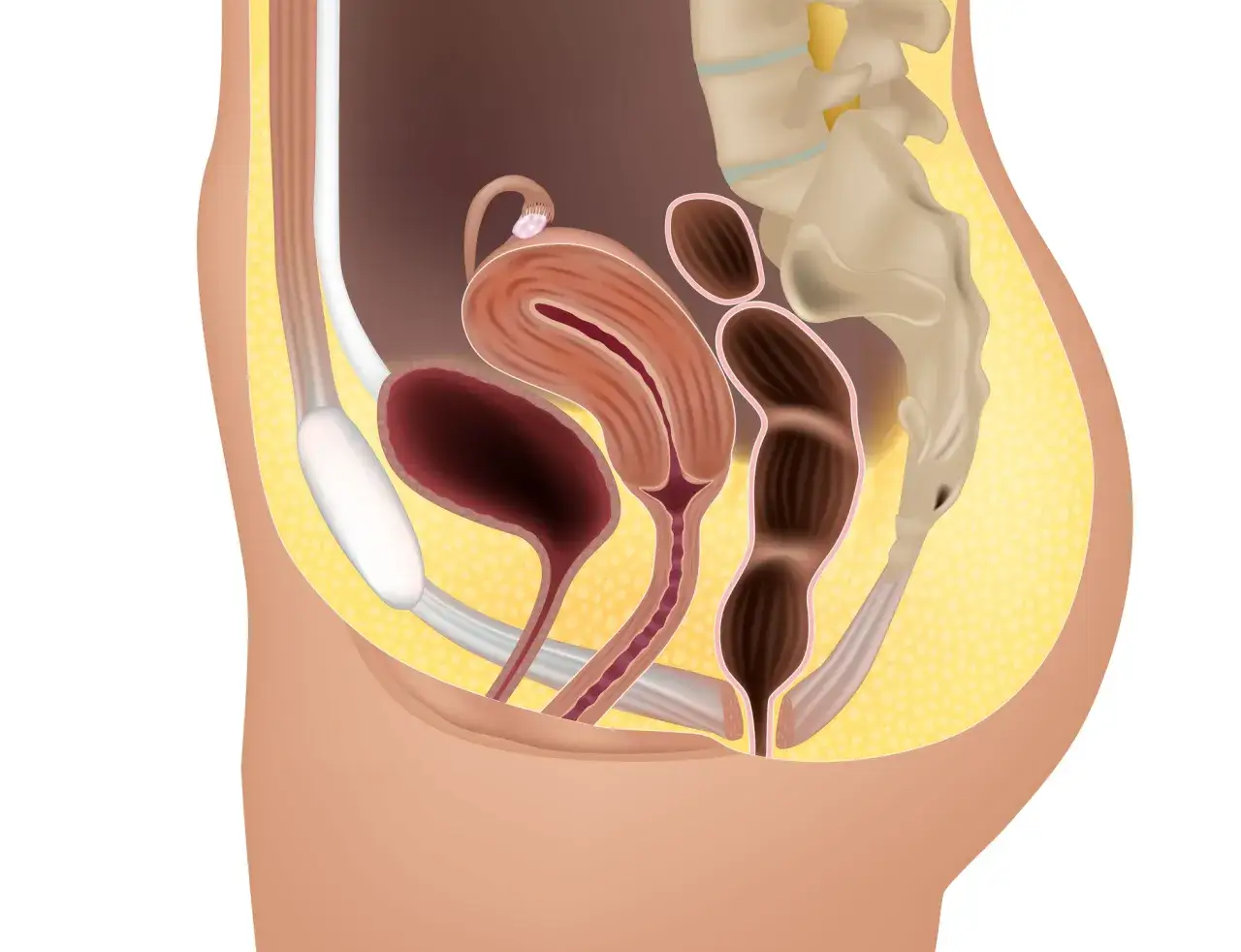 Anatomia miednicy. Ból podczas stosunku przy wejściu do pochwy może być związany z różnymi czynnikami, widocznymi na tym schemacie.