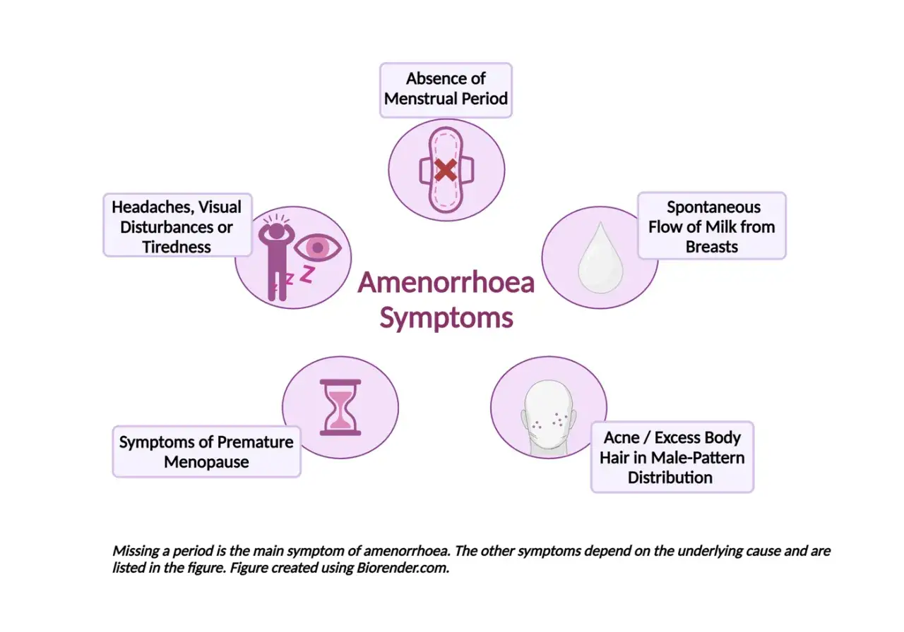 Długotrwały brak miesiączki (amenorrhea) objawia się brakiem okresu, bólami głowy, zmęczeniem, mlekotokiem, objawami menopauzy, trądzikiem i nadmiernym owłosieniem.